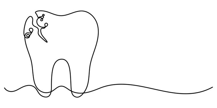 black line art tooth with cavity clip art preview