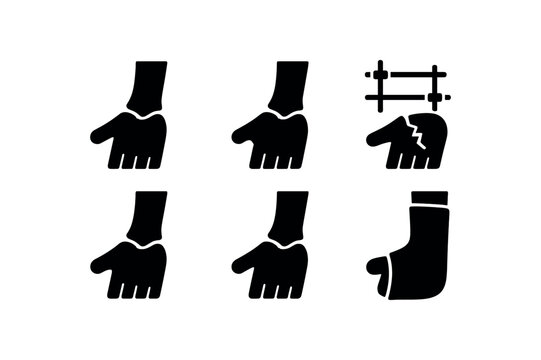 solid icon isolated wrist fracture Colles plate wrist fracture Smith's plate wrist fracture eternal fiator wrist fracture lunate wiring wrist fracture scaphoid screw wrist fracture cast