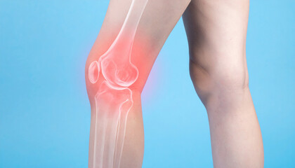 Human Knee Joint Pain Illustration with X-ray Bones on Blue Background