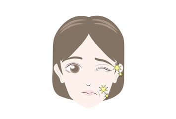 顔面神経痛で表情が変わる女性