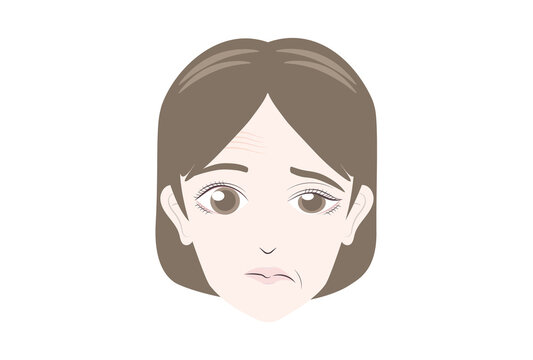 顔面麻痺の女性