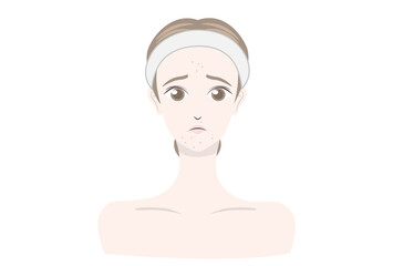 ニキビに悩む女性のイラスト