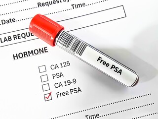 Blood sample tube and paper order request for free PSA test analysis.