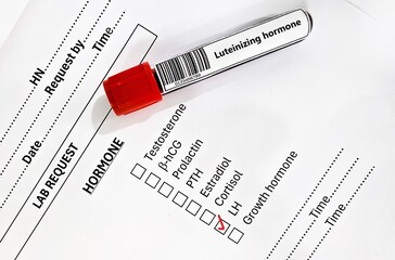 Blood sample tube and paper order request for luteinizing hormone test analysis.