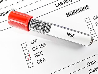 Blood sample tube and paper order request for NSE test analysis.