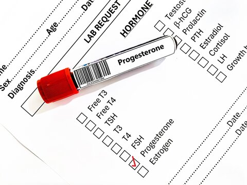 Blood sample tube and paper order request for progesterone test analysis.