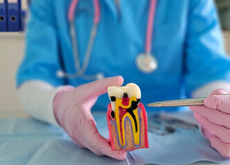 A dental expert explains root canal treatment with a colorful model showing tooth anatomy closeup
