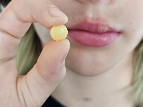 Herpes treatment, best remedies and pills for the virus. Herpes on the lip and shingles concept