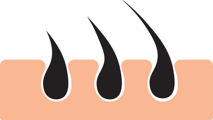 Hair growth structure vector design