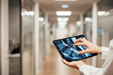Doctor analyzing AI CT images on tablet in modern medical corridor