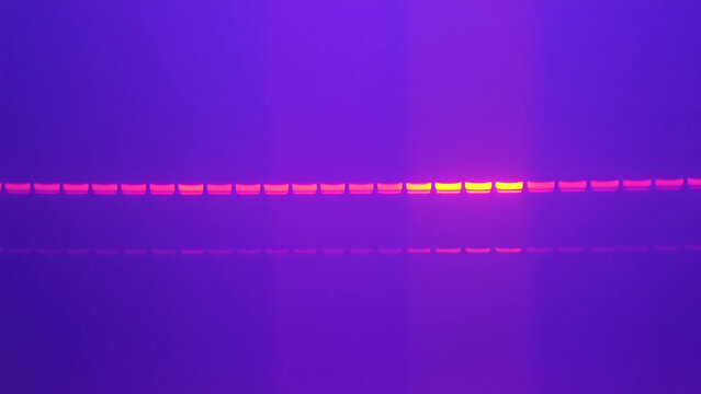 
Gel electrophoresis of 16S rRNA gene amplification,
DNA bands from foodborne pathogen detection,
ladder marker (100-1000bp) as reference,
UV transilluminator glow,
with Nanodrop concentration reading