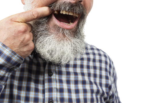 Close-up of senior man pointing at missing tooth, highlighting dental health issues