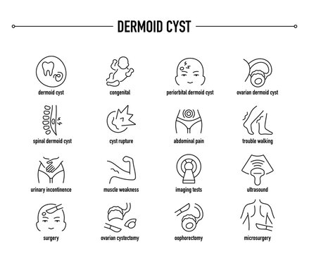 Dermoid Cyst, diagnostic and treatment vector icon set. Line editable medical icons