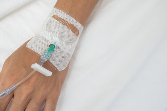 Close-up of a cannula inserted into patient's hand for intravenous therapy