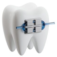 3D Dental Tooth Model with Orthodontic Braces and Blue Wire, illustrating dental care and alignment treatment on white.