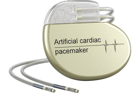 Artificial cardiac pacemaker, artificial pacemaker.