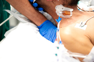 Doctor checking central venous catheter of patient in hospital