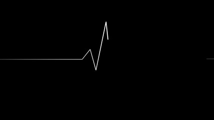 ECG cardiogram oscilloscope. Heartbeat line showing.Heart beat cardiogram.