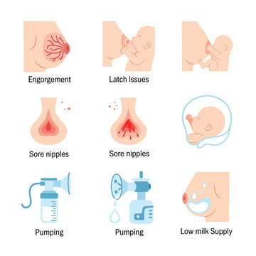Illustrations depicting various breastfeeding challenges and solutions, showing related issues.