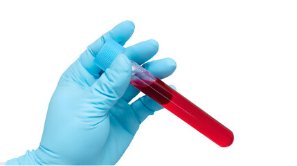 A real photo of a hand with a light blue glove holding a tube of EDTA containing red liquid on transparent background