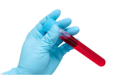 A real photo of a hand with a light blue glove holding a tube of EDTA containing red liquid on transparent background