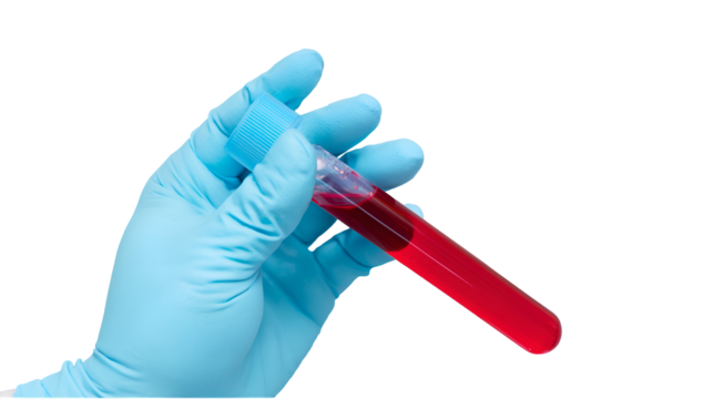 A real photo of a hand with a light blue glove holding a tube of EDTA containing red liquid on transparent background