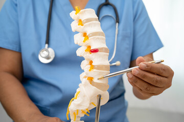 Doctor with lumbar vertebra bone skeleton and nerve model for treatment in the orthopedic...