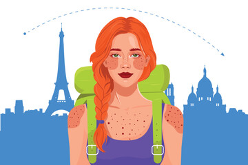 Female red haired traveler with sunburn and backpack in Paris. Honest depiction of real travel life – not just joy, but fatigue and sun damage. Vector art for travel, health, lifestyle themes.