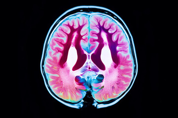 Brain Scan Illustration: A visually striking and detailed representation of brain anatomy, displayed in vibrant colors on a stark black backdrop.