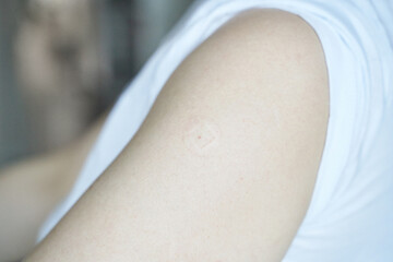 Close up of bare caucasian skin with small square mark on upper arm in soft light.