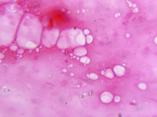 Histology Microscope Image of Mammal Adipose Cells with Lipid Droplets (400x)