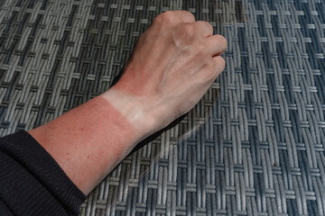 The man's tanned red hand, the white mark from the watch