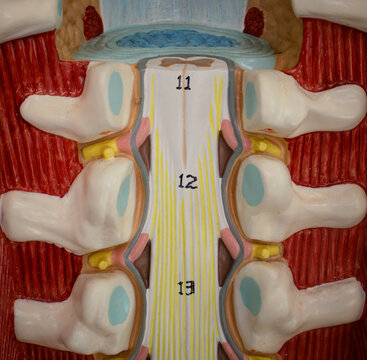 Spinal Cord Conus Medullaris and Cauda Equina Region