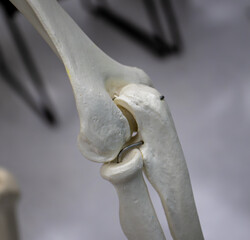 Posterior Elbow Joint With Radius, Ulna, and Humerus Bones