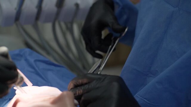 Close-up. surgeon's hands, black gloves, perform operation remove impacted wisdom tooth together assistant, nurse. Saliva ejector blood. Surgical suit, uniform. wound mouth sutured clamp. Sleep