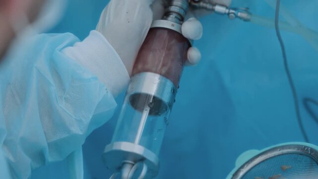 Surgical procedure: laparoscopy operation for prostate adenoma treatment.