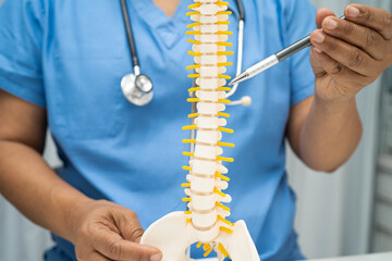 Asian doctor holding spinal nerve and bone model, Lumbar spine displaced herniated disc fragment...