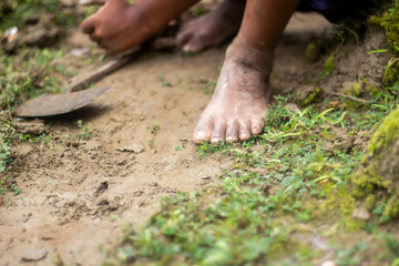 A man put his leg on the grass ground