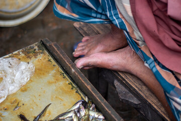 A man shows his leg on the fish table in the market