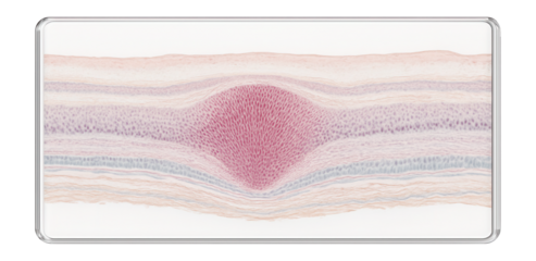 Histological slide of the fovea centralis with high cone density and thin retinal layers