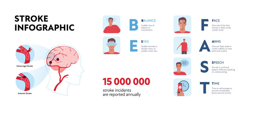 Brain neural disease for healthcare infographic. Vector flat illustration. Be fast stroke diagnostics with symptoms poster. Design for health care