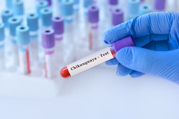Fototapeta premium Doctor holding a blood sample tube with Chikungunya test label in front of medical test tubes,symbolizing laboratory diagnosis, virus detection, healthcare,Alphavirus,mosquito-borne disease prevention