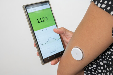 Patient checking glucose level on smartphone with continuous glucose monitoring sensor on arm