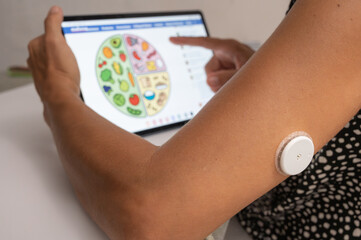 Patient with continuous glucose monitoring sensor using tablet to check nutrition plan