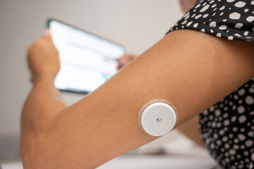 Patient applying continuous glucose monitoring sensor on arm while using tablet