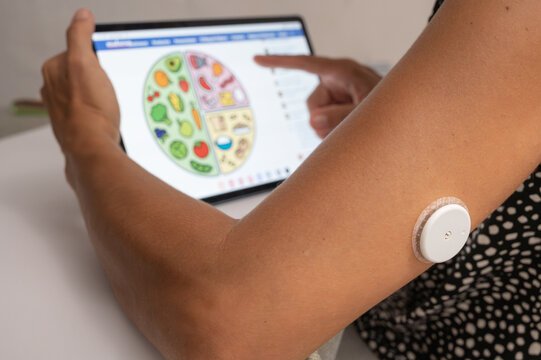 Patient with continuous glucose monitoring sensor using tablet to check nutrition plan