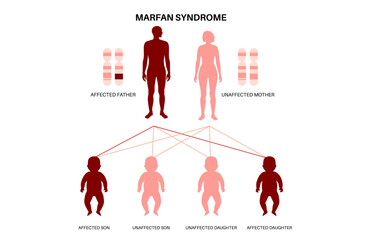 Marfan syndrome poster
