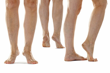 Elderly woman’s legs and feet showing visible skin conditions such as spider veins, dry and...