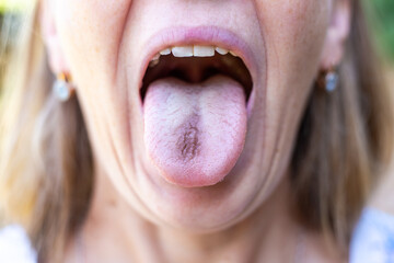 Open female mouth with blue tongue inside. Tongue coloring