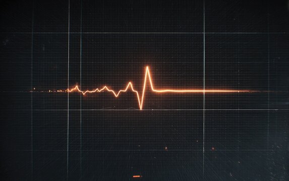 EKG monitor, heartbeat graph